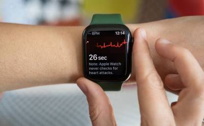 FDA официально признала функцию отслеживания мерцательной аритмии в Apple Watch медицинским инструментом